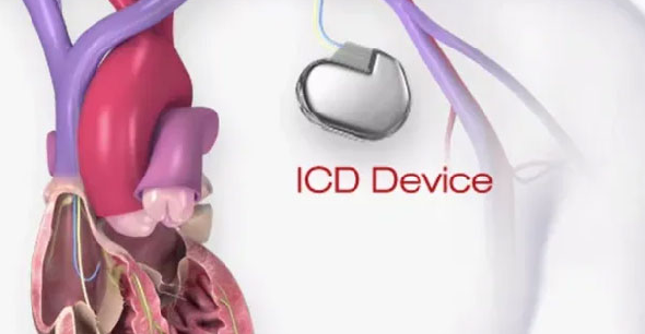 ICD Device Image