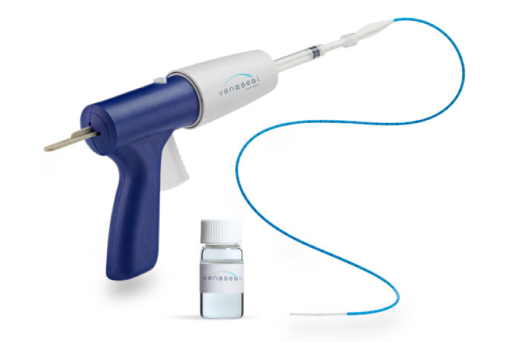 VenaSeal Treatment